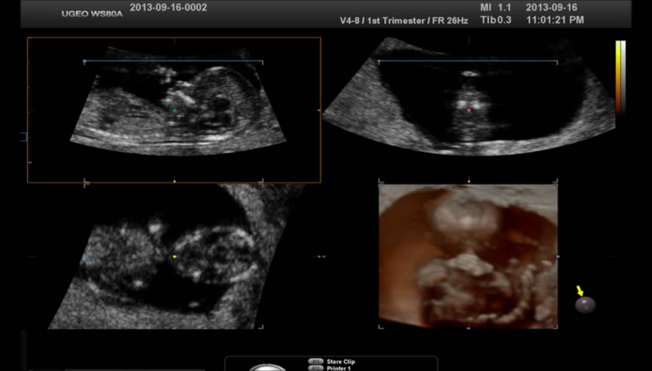 1633447447100685.png 22.png