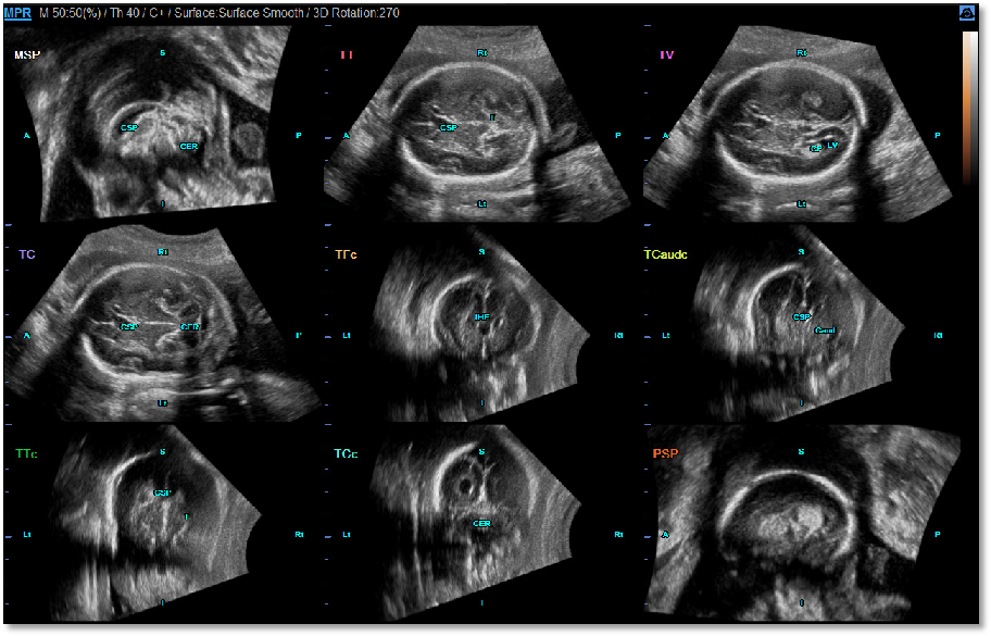 1633447478130567.png 222.png