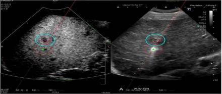 1635340795101912.png image.png