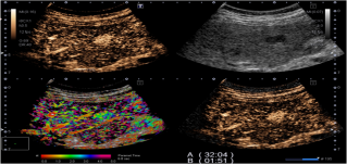 1635340945475587.png image.png