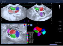 1635340967137895.png image.png