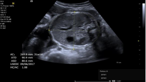 1635688876837828.png image.png