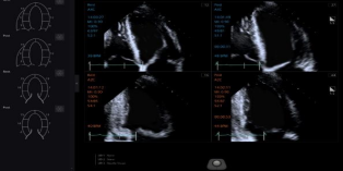 1635688888155430.png image.png