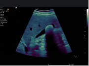 1635689011675728.png image.png