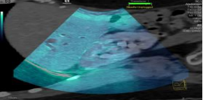 1635860294702149.png image.png