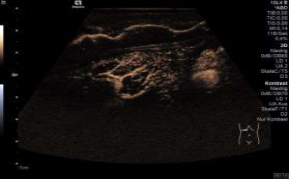 1635860312109472.png image.png