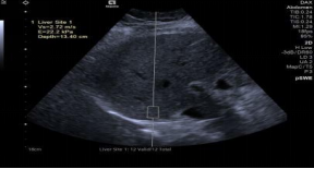 1635860419416934.png image.png