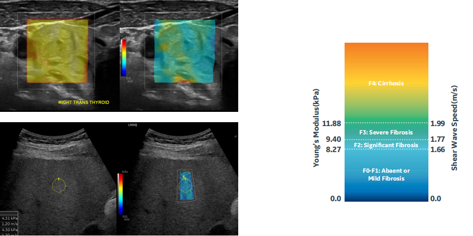 1639206135181421.png 1639206129(1).png