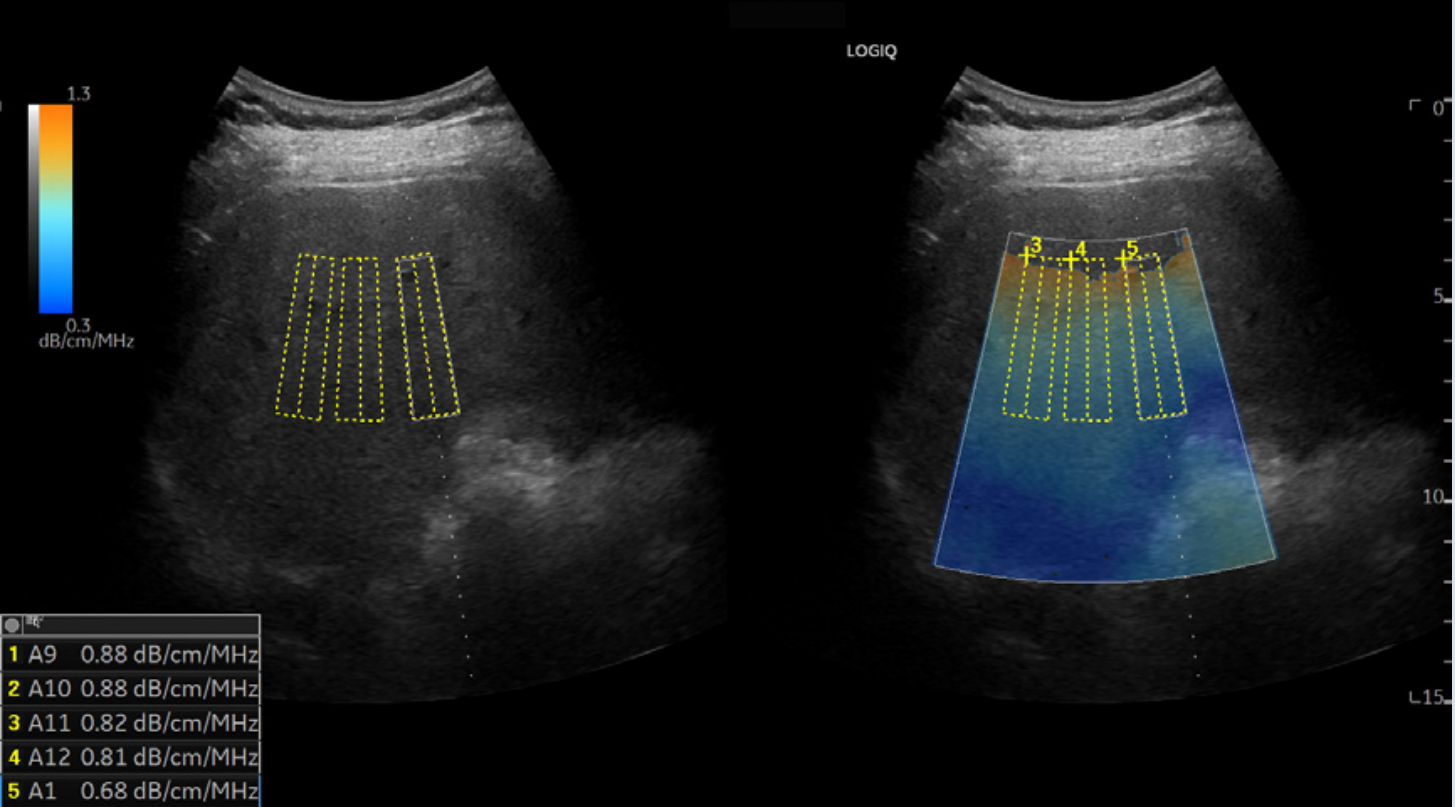 1639208085720352.png 1639208060(1).png