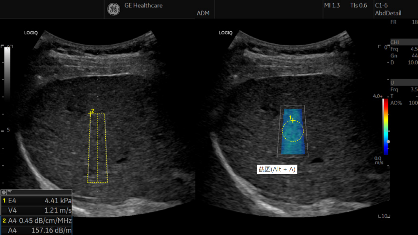 1639208287118870.png 1639208281(1).png