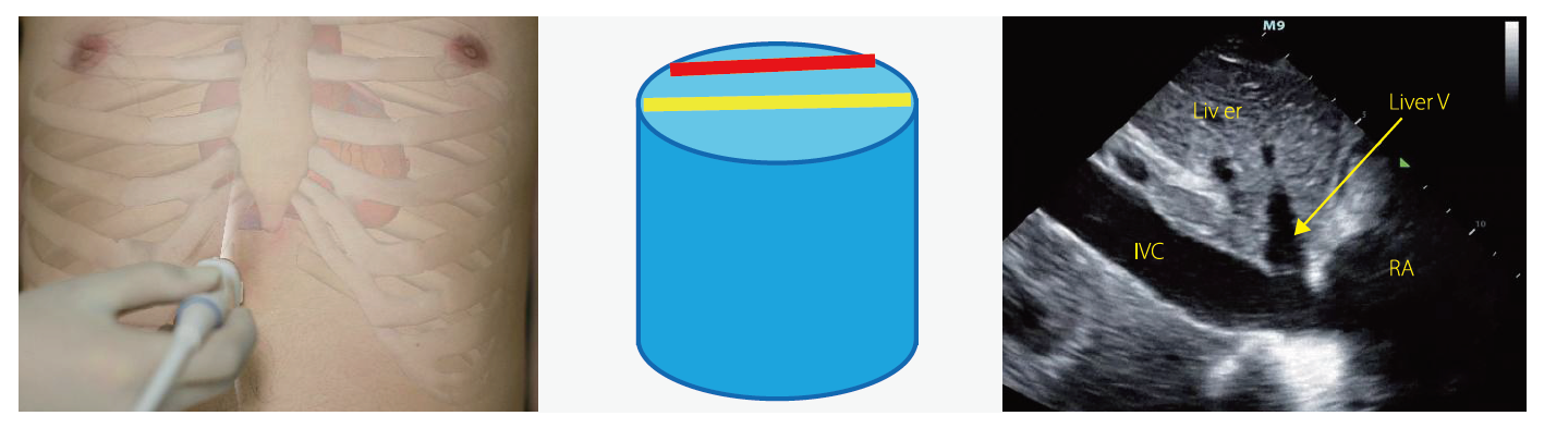 eabaeea7624b29c740c0ab0ed020951.png