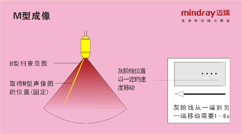 M型成像.gif