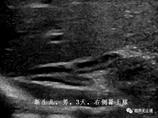 4e962a81d533e26bd3e8e31a131dc045.png