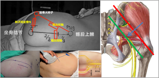 1683424469166662.jpg 1683424458587.jpg