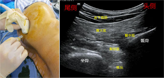 1683424488127722.jpg 1683424484726.jpg