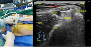 1683434385123113.png image.png