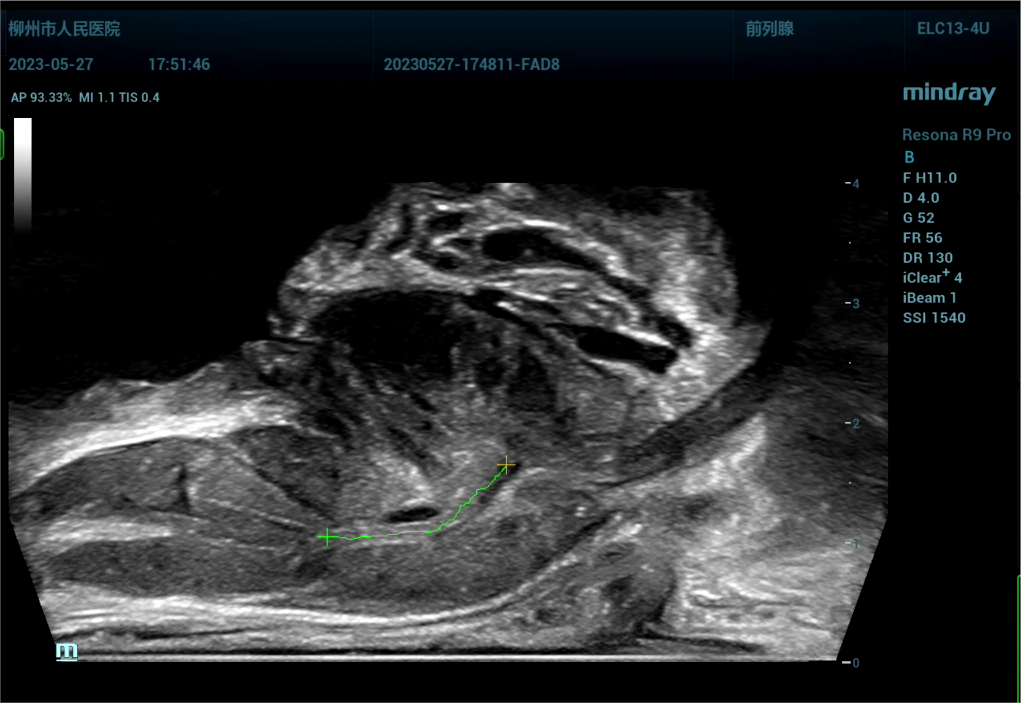 443081 截取视频 截取视频 截取视[00_23_49][20230614-071701].png