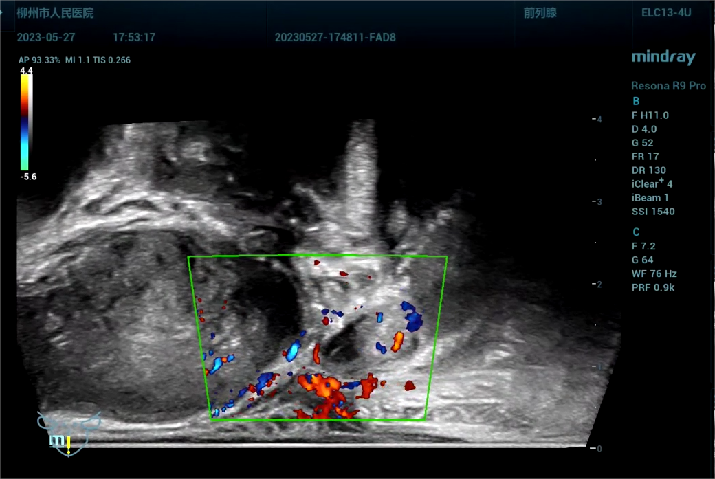 443081 截取视频 截取视频 截取视[00_24_56][20230614-071830].png