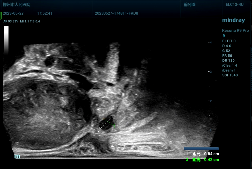 443081 截取视频 截取视频 截取视[00_24_28][20230614-071739].png