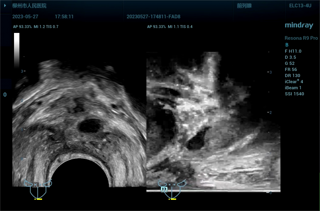 443081 截取视频 截取视频 截取视[00_01_11][20230614-074802].png