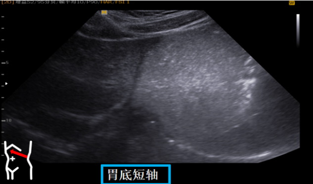 1687574273453641.png image.png