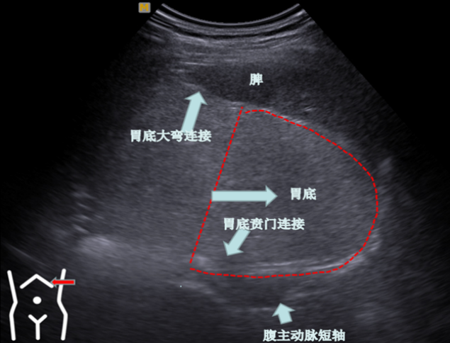 1687574304101709.png image.png