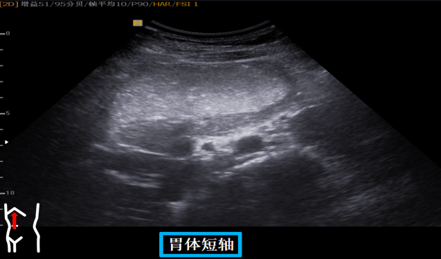 1687574342107867.png image.png