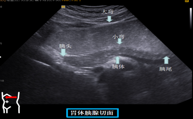 1687574356140292.png image.png