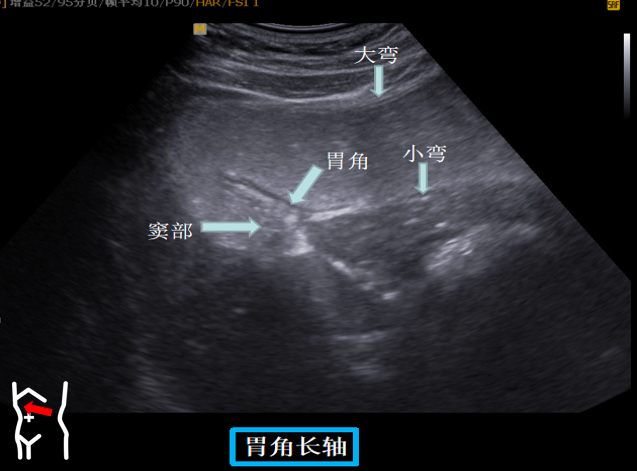 1687574373128028.png image.png