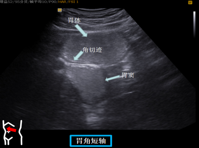 1687574387489271.png image.png