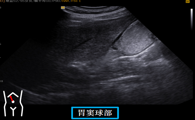 1687574787426746.png image.png