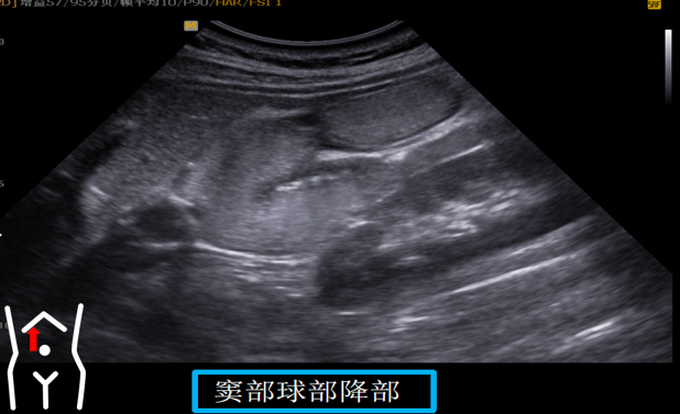 1687574808958489.png image.png