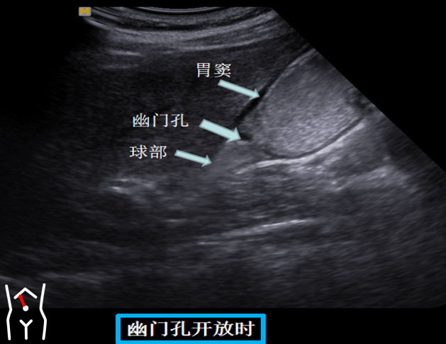 1687574930958532.png image.png