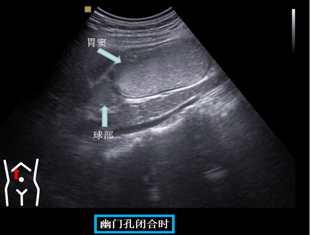 1687575010130691.png image.png