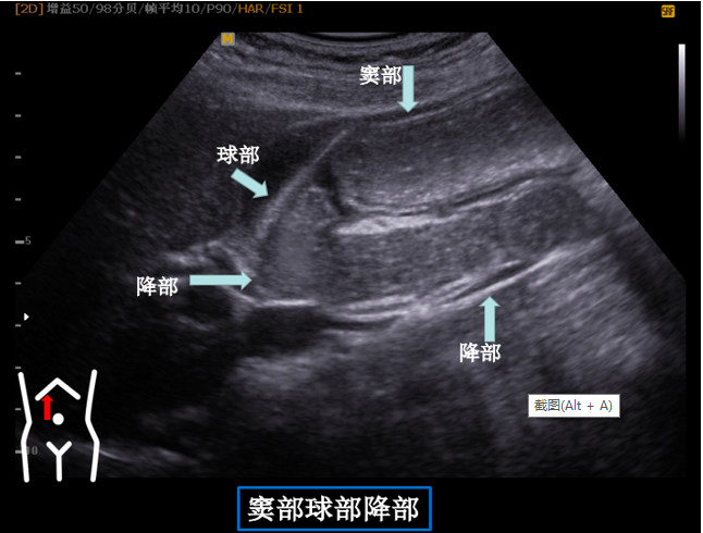 1687575067115626.png image.png