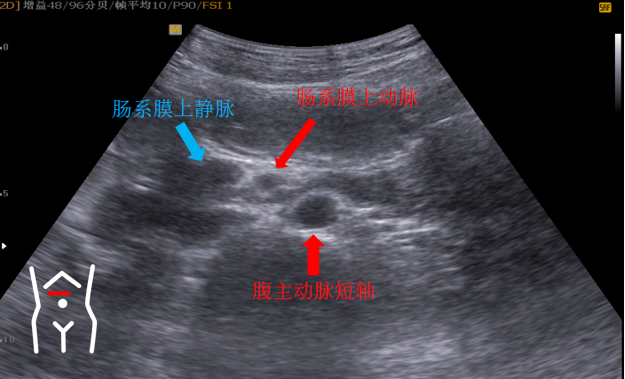 1687575315566642.png image.png