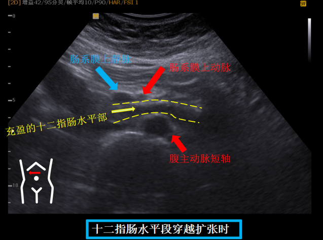 1687575458117012.png image.png