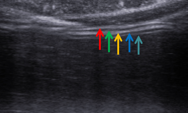 1687575641124056.png image.png